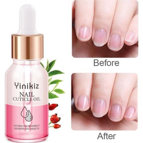15ml Nutritional Oil Anti Barb Dead Skin Repair Moisturizing Care Nail Enhancement Multicolor Finger Edge Nail Tool