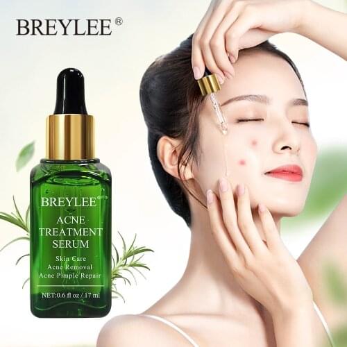 BREYLEE Acne Treatment Face Serum Mask Anti Pimple Acne Scar Remover Moisturizing Whitening Skin Care Facial Essence Cream 17ml