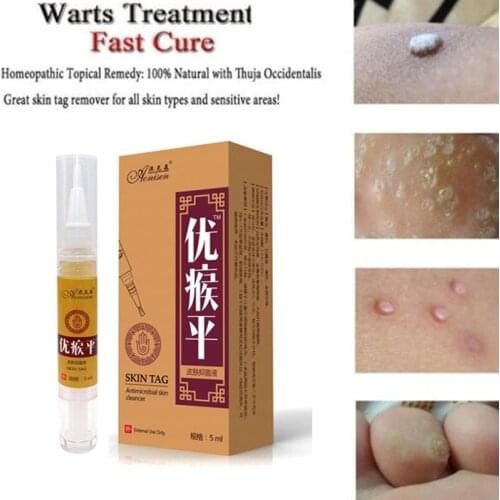 Ultra Strength Skin Tag Remover Liquid Pen Foot Corn Body Tag Mole Wart acne remover 12hours repair Medical care Tool Useful 5ml