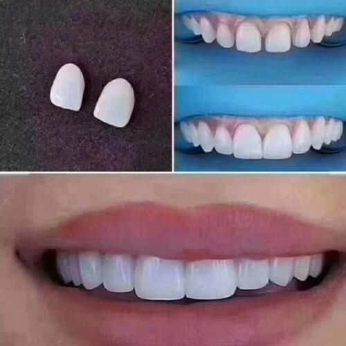2Pcs No.33# Dental Veneers Whitening Ceramic Bright White LMS