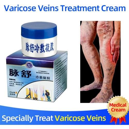 Herbal Medicine For Treating Varicose Vasculitis Phlebitis Spider Legs Veins Pain Massage Cream Treat Varicose Vein Ointment