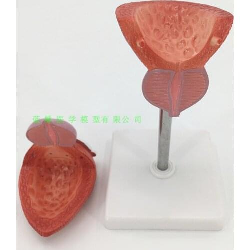 Bladder model This model shows the prostatic urethra around the male bladder