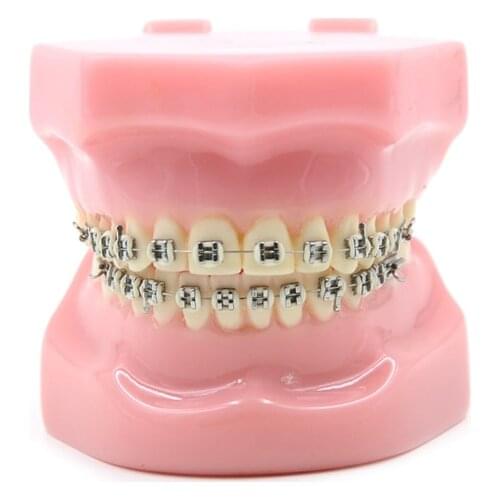 New Arrival Dental Orthodontics Typodont Teeth Model Metal Brace bracket Typodont with Arch Wire