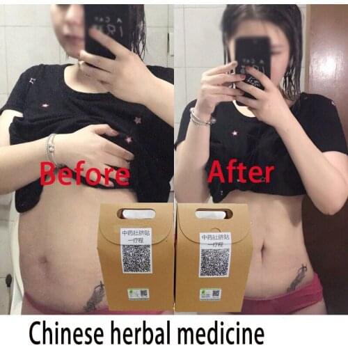 80pcs Sliming Patch Navel Sticker Slimming Products Fat Burning Losing Weight Cellulite Fat Burner Weight Loss Paste Belly Waist