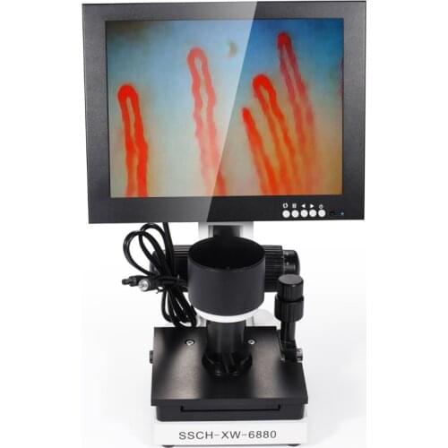 2020 Nailfold capillary microcirculation microscope blood test machine