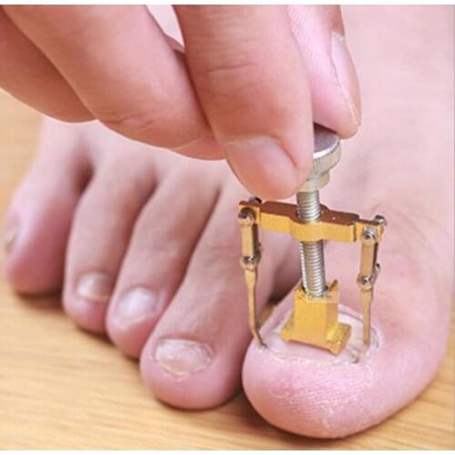 1pc Feet Toe Nail Correction Tool Treatment of Paronychia Fixer Recover Device Protector Pedicure Foot Care Acronyx
