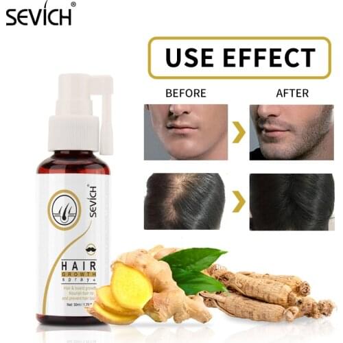 Sevich 50ml Hair Growth Products Ginger Fast Growing Hair Loss Care Spray Beauty Hair & Scalp Treatment for Men Women