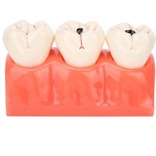 Ydf Products For Teeth Whitening