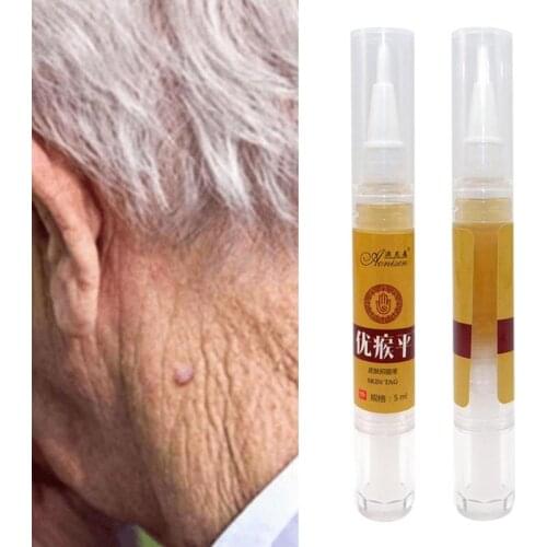 10ml Skin Tag Remover Pen 12 Hours Medical Tu Kill Remover Skin Tag Mole Genital Wart Remover Foot Corn Removal Pen Free Ship