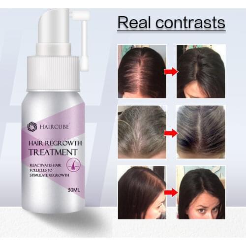 HAIRCUBE Hair Growth Essence Oil Spray for Women Fast Hair Growth Nourishing Treatment Anti Hair Loss Liquid Repair Damaged Hair