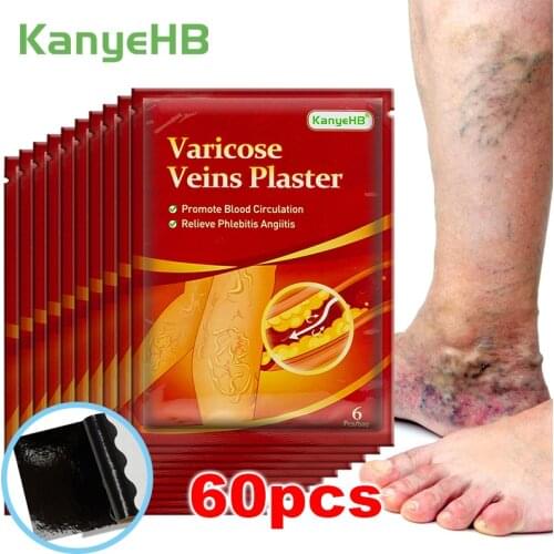 18/30/42/60pcs Varicose Veins Ointmnet Vasculitis Phlebitis Spider Cream Varicosity Angiitis Removal Herbal Medical Plaster