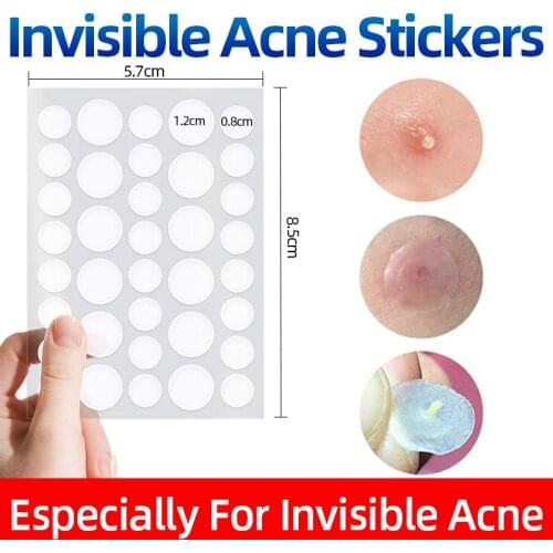 2PC Remove Acne Patch Invisible Pimple Stickers Improve Blackheads Scar Marks Repair Skin Care Beauty Tool