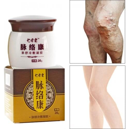 20G Varicose Vein Treatment Cream Repair Vasculitis Phlebitis Massage Relieve Swelling Nourish Mineral Vegetable Oil Body Care