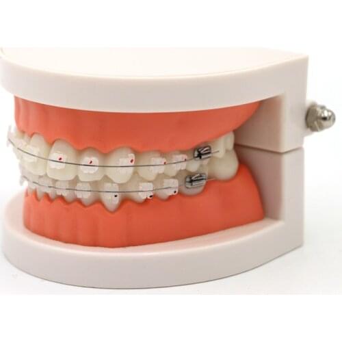 1pc Dental Treatment Orthodontic Model With Orthodontic Full Ceramic Bracket Arch Wire Buccal Tube Ligature Ties