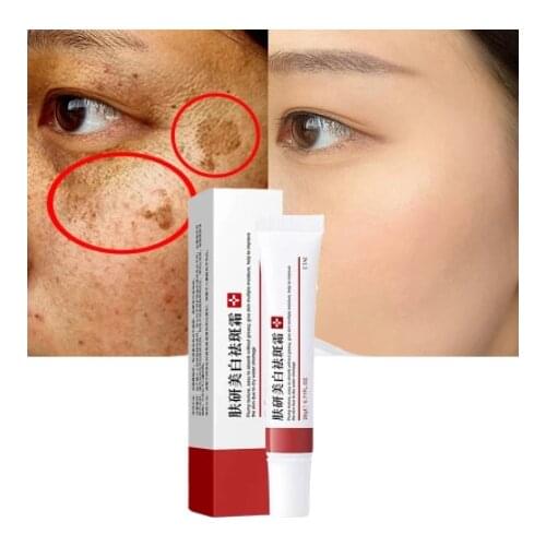 Dark Spot Makeup Remover Cream Oil Control Moisturizing Remove Grease Moles Whitening Cream Freckle Freckle Cream