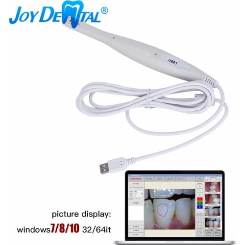 Dental USB Intraoral Camera Digital Oral Endoscope U801 8 white Cold Light LED Automatic Focusing 2M Cable Resolution 1920x720