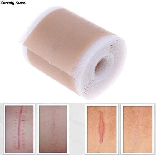 4x150cm Efficient Surgery Scar Removal Silicone Gel Sheet Therapy Patch For Acne Trauma Burn Scar Skin Repair Scar Treatment