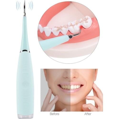 Portable Electric Ultrasonic Dental Scaler Tooth Calculus Remover Cleaner Tooth Stains Tartar Tool Whiten Teeth Tartar Remove