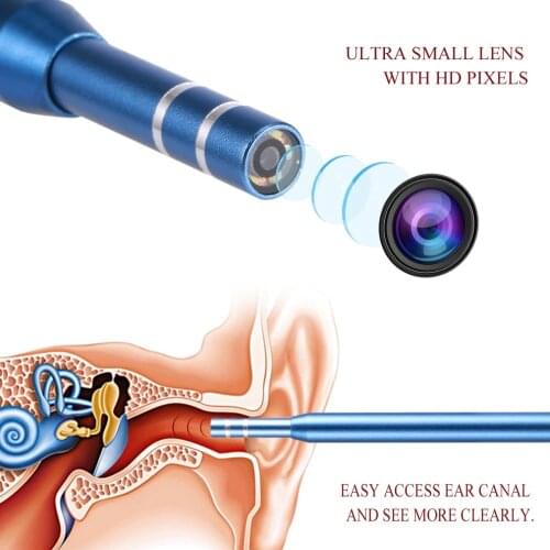 Type-C Android Endoscope Ear Inspection Camera Ear Canal Cleaning Endoscope Pore Enlargement For Acne Removal USB Camera For PC