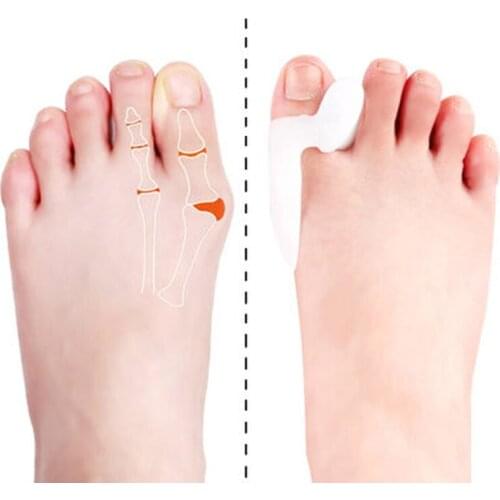 1Pair Hallux Valgus Bunion Corrector Pedicure Silicone Gel Bunion Big Toe Separator Spreader Eases Foot Pain Adjuster Correction