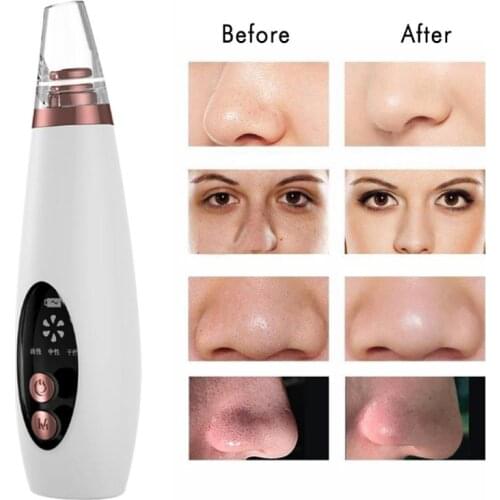 6 in 1 Electric Blackhead Remover Facial Pore Cleaner Vacuum Acne Cleanser Deeply Cleaning Compact Skin Care Tool TSLM1