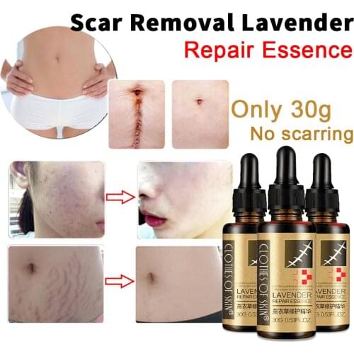 30g Lavender Essence Scar Repair Skin Essential Oil Natural Pure Remove Ance Burn Strentch Marks Scar Removal