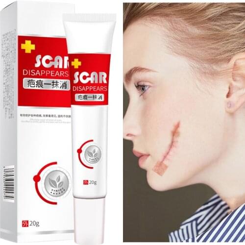 20g Facial Acne Scar Removal Cream Skin Care Cell Regeneration Cream Acne Spots Treatment Stretch Marks Relief Cream