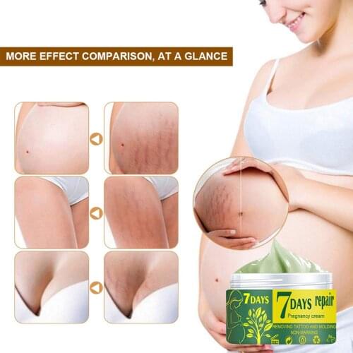 7 Days Pasjel Stretch Mark Repair Cream Powerful Obesity Pregnancy Body Marks Postpartum Cr Scar Skin Stretch Remover