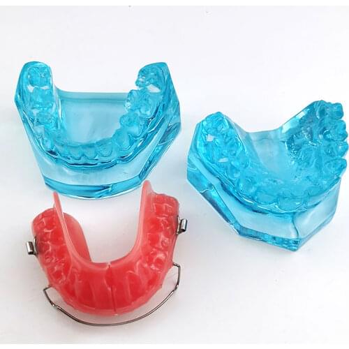 Dental Orthodontic Model with Retainer Removable Model Dental Education Model