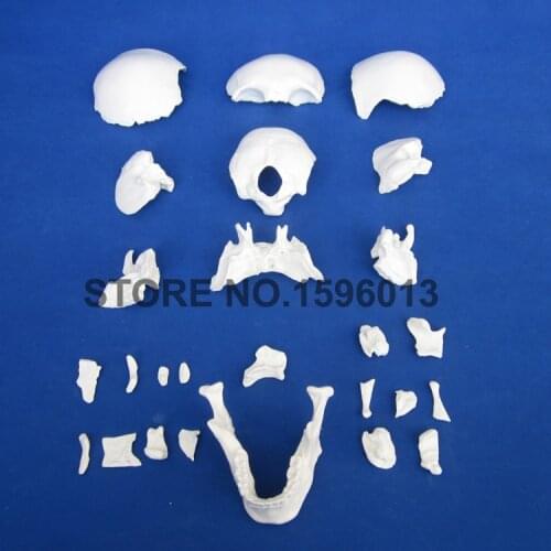 HOT Advanced Scattered bones of skull model, Skull dispersive bone model ,Skull model