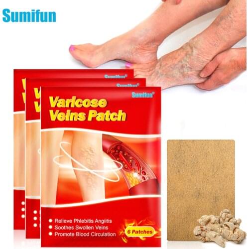 12pcs New Sumifun Varicose Veins Plaster Vasculitis Phlebitis Spider Cream Varicosity Angiitis Removal Herbal Medical Plasters