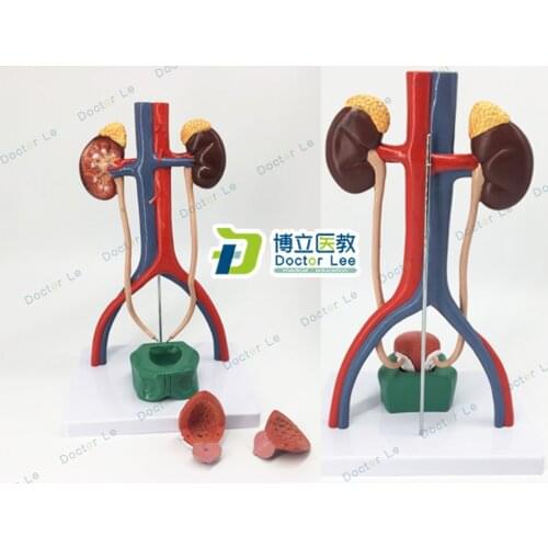 Human Urinary System Anatomical Model Kidney Ureter Bladder Urethra Anatomical Model Medicine Urology