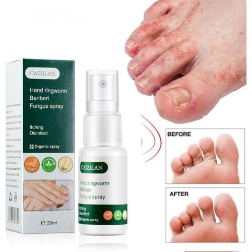 Hand and Foot Skin Spray Hand and Foot Spray Suitable for Dry and Cracked Skin