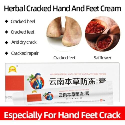 20g Herbal Medicinal Antifreeze Antibacterial Cream Treatment Hand Foot Skin Dry Crack Heel Chapped Peeling Care Plaster