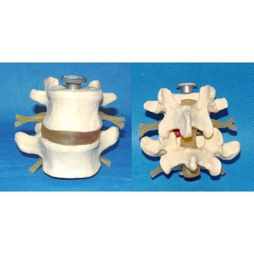 1:1life Size Human Skeleton Model Assemble Two Lumbar Intervertebral Discs Medical Teaching Explanation