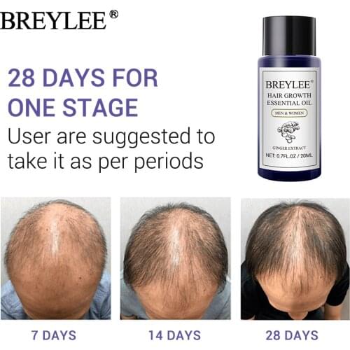 BREYLEE Hair Growth Essential Oil Fast Powerful Hair Products Hair Care Prevent Baldness Anti-Hair Loss Serum Nourishing 20ml