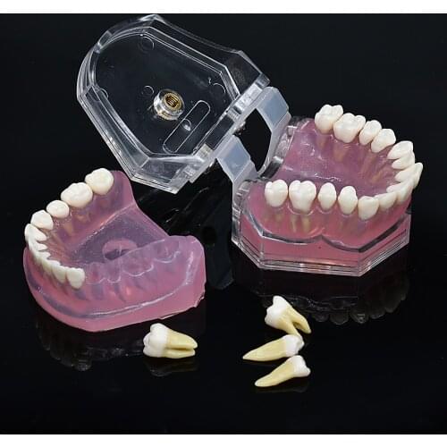 Dentist Soft Foundation Model separate Tooth Suck out pull up Teaching model Tooth Removable Dental Models dental lab instrument