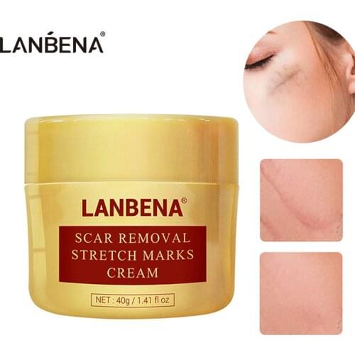 LANBENA Scar Removal Cream Acne Treatment Repairing Scar Non irritating Whitening Cream Anti Winkles Moisturizing Skin Care 40g