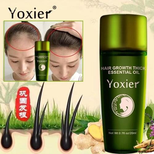 Effective Fast Growth Hair Care Serum Moisturizing Anti-Hair Loss Scalp Repair Anti-Dry Anti-Breaking Ginger Scalp Treatment