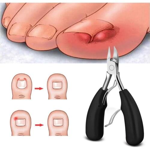 Stainless Steel Toe Nail Clippers Cuticle Nippers Manicure Pedicure Cutters Dead Skin Dirt Remover Podiatry Cut Toenails Claw Cu