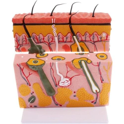 3D Skin Section Model Skin Anatomical Model Human Skin Hierarchical Structure Model Education Learning Tool