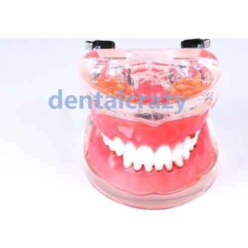 Dental Model tools Typodont Teeth Model Adult Pathological Periodontal disease 4017