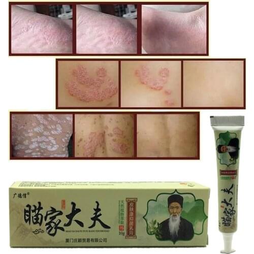 100% Natural Herbal Creams Body Psoriasis Cream Perfect For Dermatitis and Eczema Pruritus Psoriasis Skin Problem Plaster