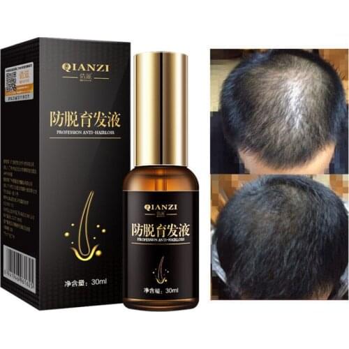 Fast Hair Grow Essence Serum Anti Hair Loss Treatment Promote Hair Follicle Growth Nourishing Hair Regeneration Repair