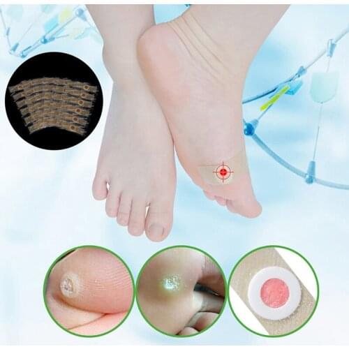 NEW Foot Care 42Pcs Foot Corn Removal Plaster Warts Thorn Calluses Plantar Treatment Pain Reliever Stickers