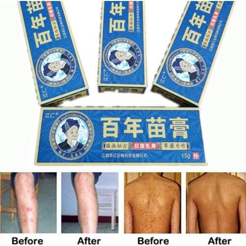 1PC 15g/Box Eczema Psoriasis Cream for Athletes Foot Jock Itch Ringworm Eczema Mosquito bites Rash Foot&Body Care Cream