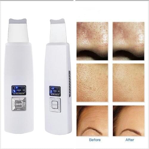 Rechargeable Ultrasonic Skin Scrubber Facial Cleaner Digital Acne Removal Skin Cleaning Ultrasound pore Peeling Face Care Tool