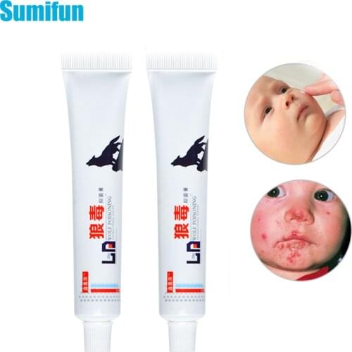 20g Psoriasis Cream Anti-itch Eczema Ointment Antibacterial Dermatitis Cream Natural Herbal Chinese Medical Plaster P1092