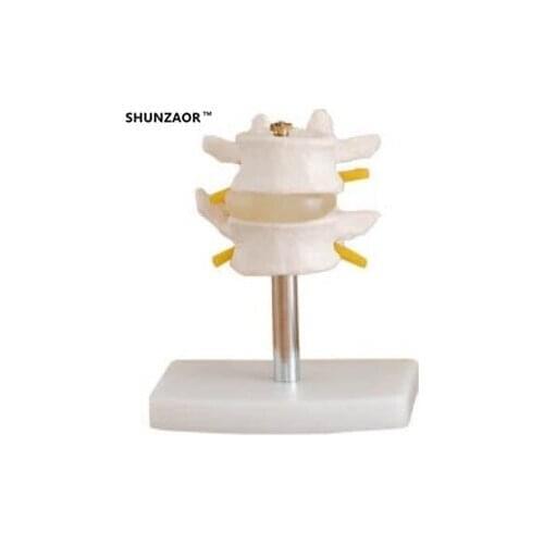 16*9*8cm Lumbar Set (2 pcs) lumbar disc herniation demonstration model,Human lumbar model medical teaching model