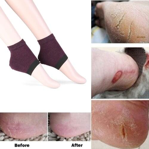 1pair new Gel Heel Socks Moisturing Spa Gel Socks feet care Cracked Foot Dry Hard Skin Protector drop shipping